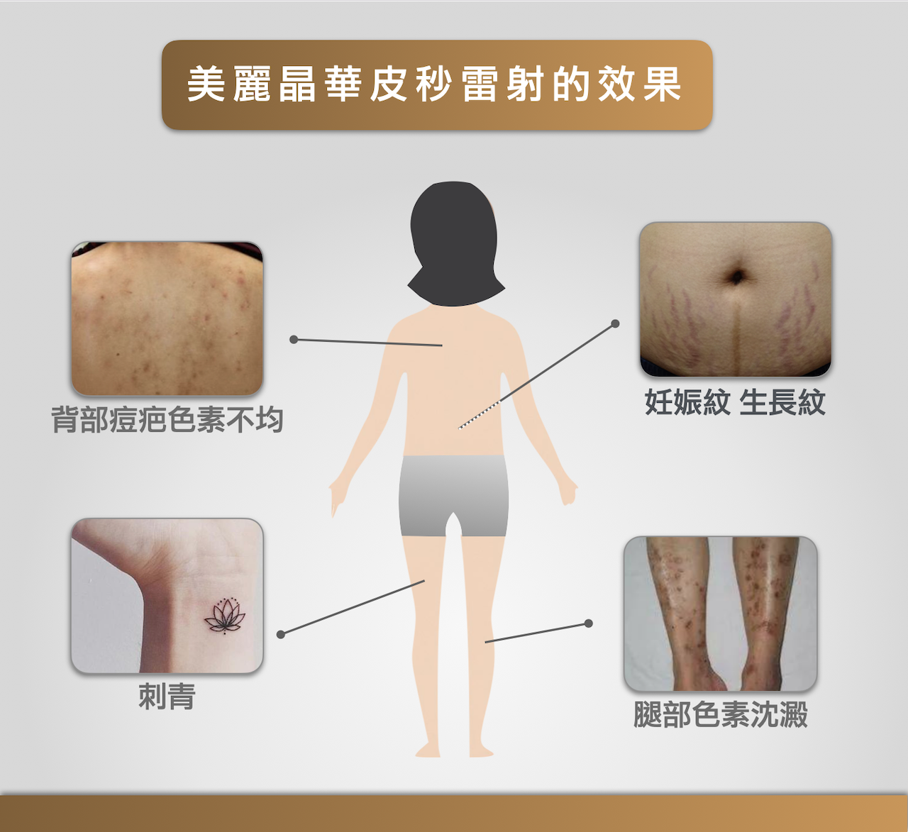 皮秒雷射效果