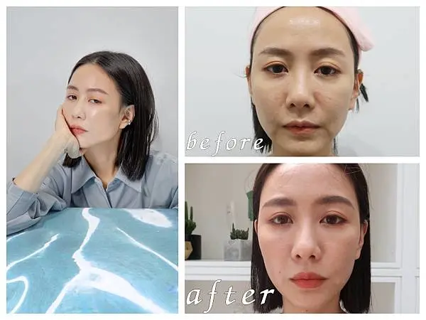 超人氣美妝Youtuber大饅大力 FLX鳳凰電波 音波拉提 / 電波拉皮分享全記錄！懶人保養學