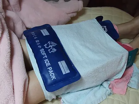 雷射除毛術後冰敷
