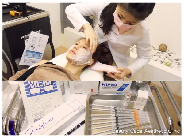 3D聚左旋乳酸術前卸麻藥準備治療