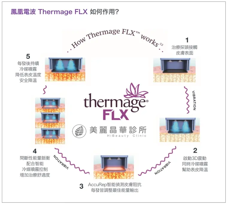 FLX鳳凰電波拉皮治療作用示意圖