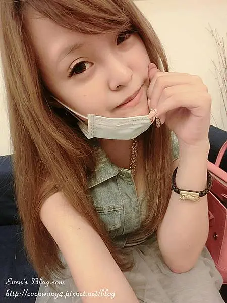 光纖粉餅雷射術前照