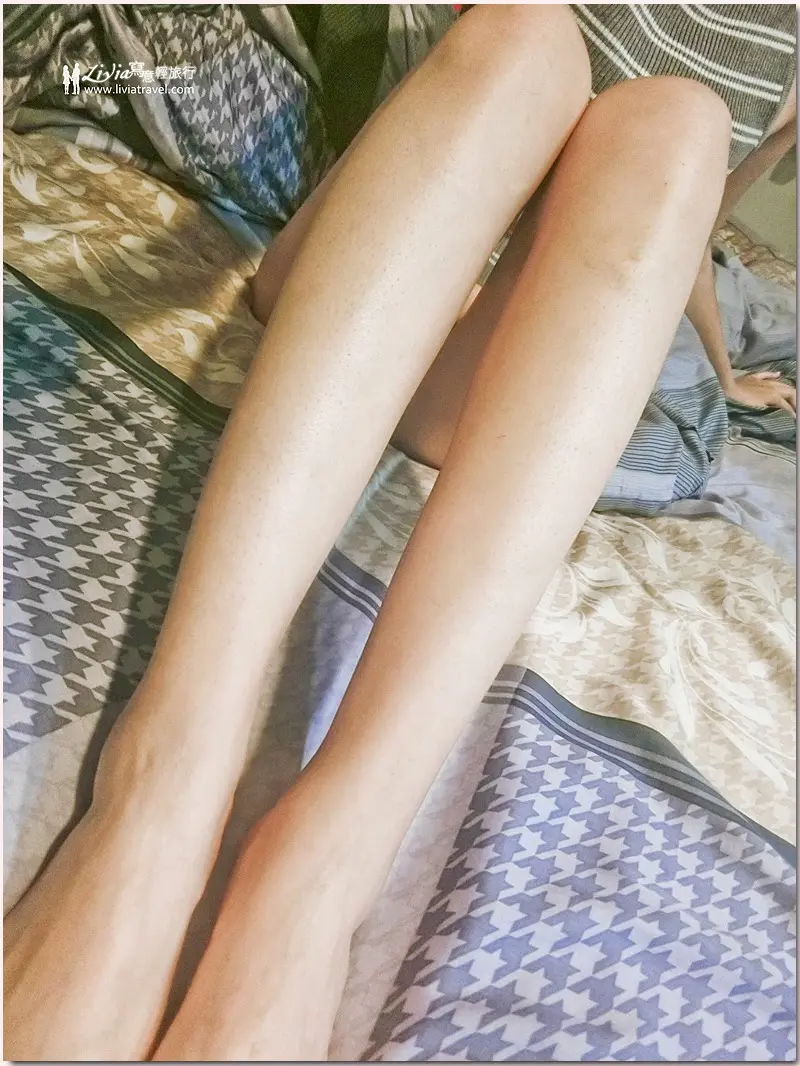 雷射除毛術後