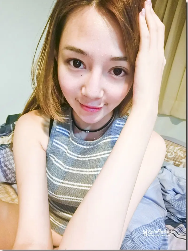 雷射除毛術後