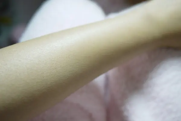 雷射除毛術前修毛