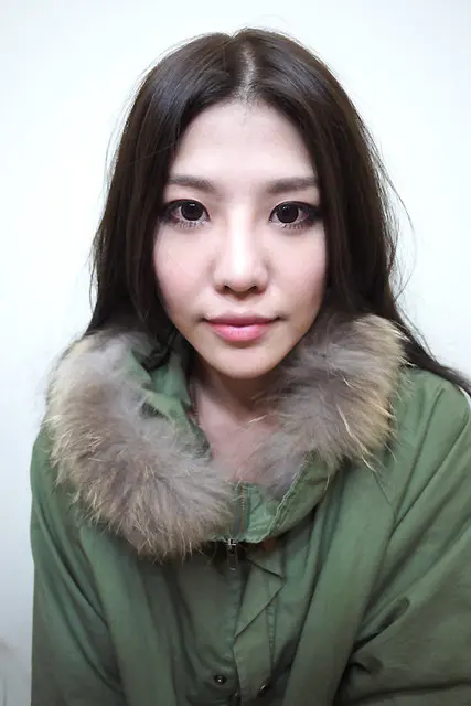 玻尿酸豐唇術前