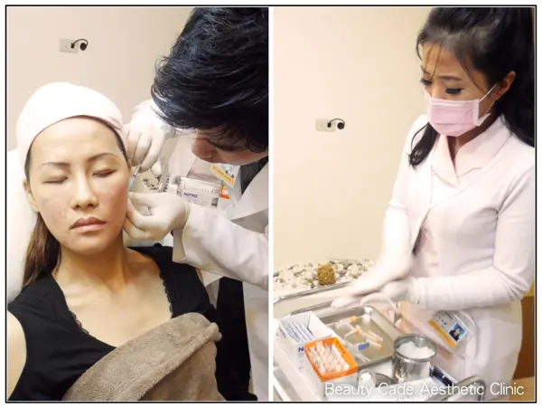 陳志龍醫師專業細心施打3D聚左旋乳酸