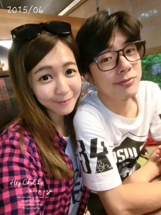 肉毒桿菌瘦臉術前