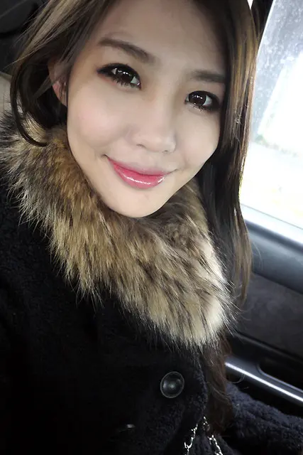 玻尿酸豐唇術後