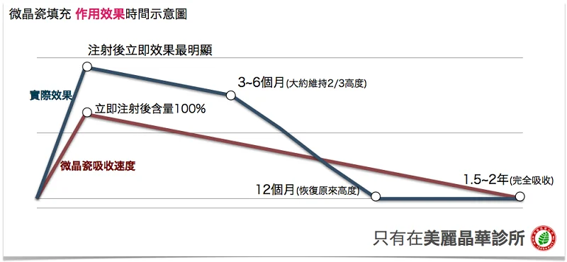 晶亮瓷(微晶瓷)填充作用效果示意圖