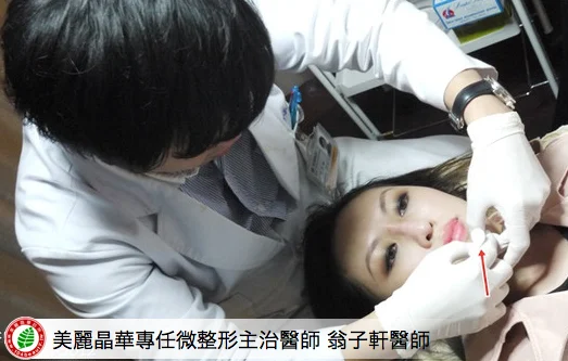晶亮瓷(微晶瓷)微整形翁子軒主治醫師