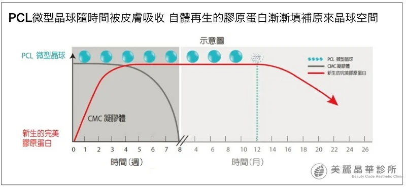 洢蓮絲Ellanse自體再生膠原蛋白