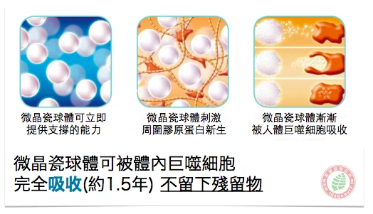 晶亮瓷(微晶瓷)吸收後不留殘留物