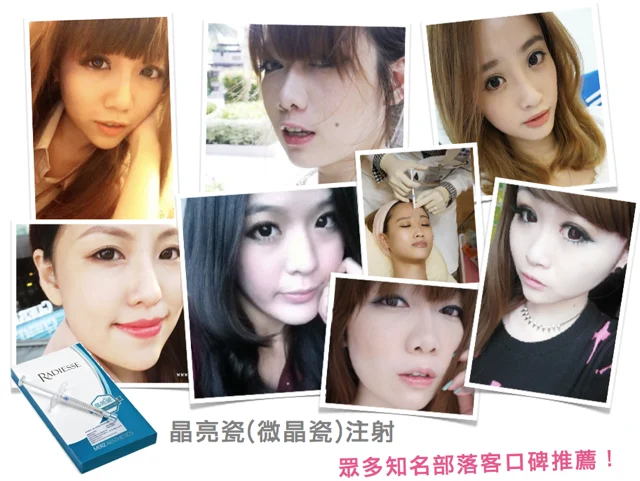晶亮瓷(微晶瓷)雕塑眾多網路名人推薦治療
