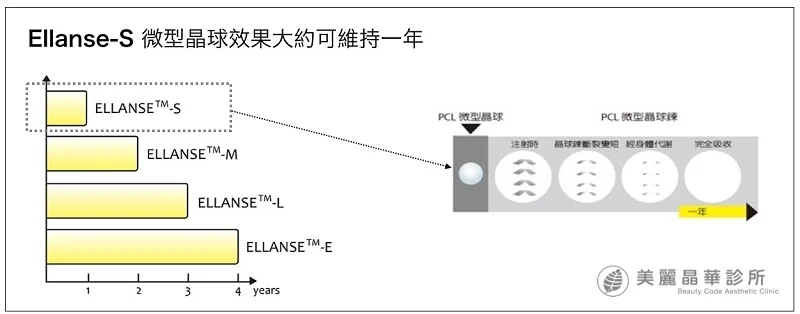 洢蓮絲Ellanse微型晶球效果大約可維持一年